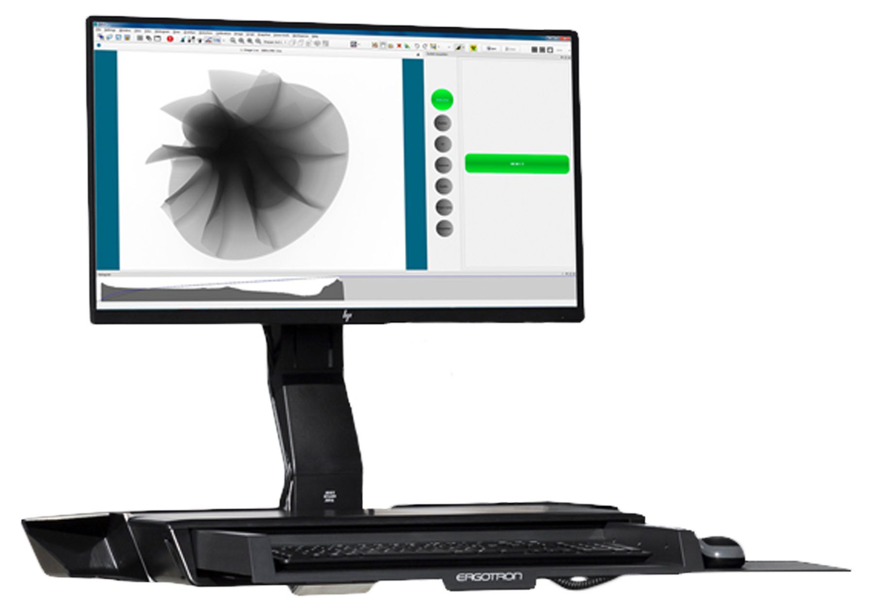 EasyTom S Computer View